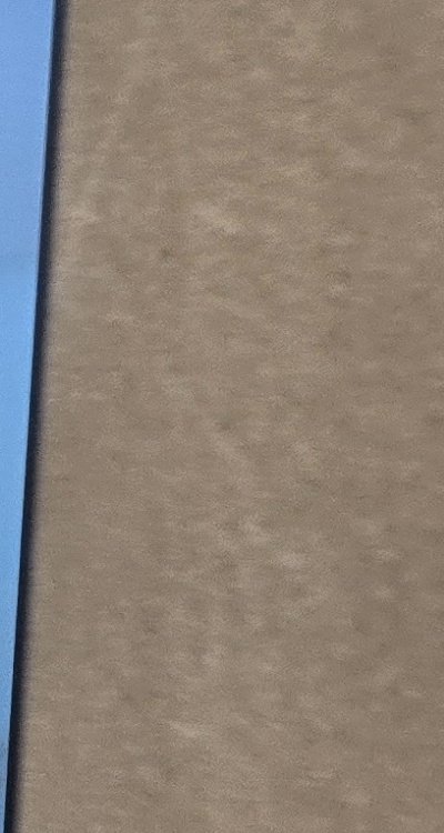 앞니 올세라믹 이건 알고 시작하세요 관련 이미지 29