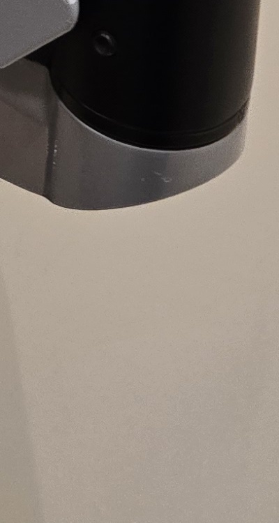 신경치료 아픈가요 망설이시는 분들이라면 관련 이미지 47