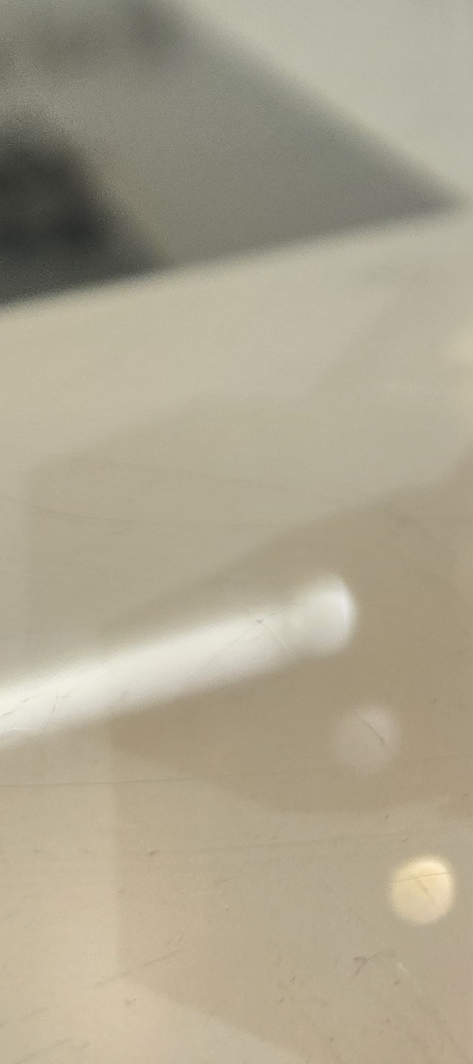 송곳니 덧니 발치 이럴때 해당되네요 관련 이미지 31