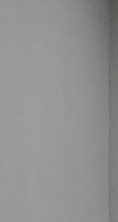 치아 발치 후 임플란트 언제부터 준비할까 관련 이미지 31