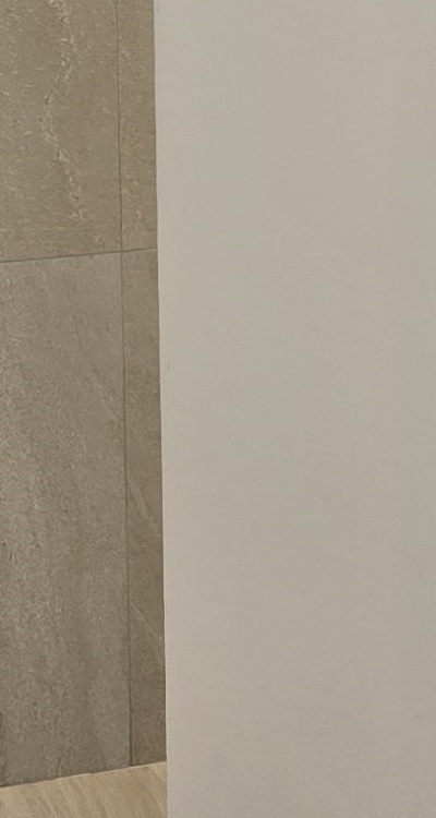 앞니 부분 교정 간단하니까 좋은건가요 관련 이미지 37