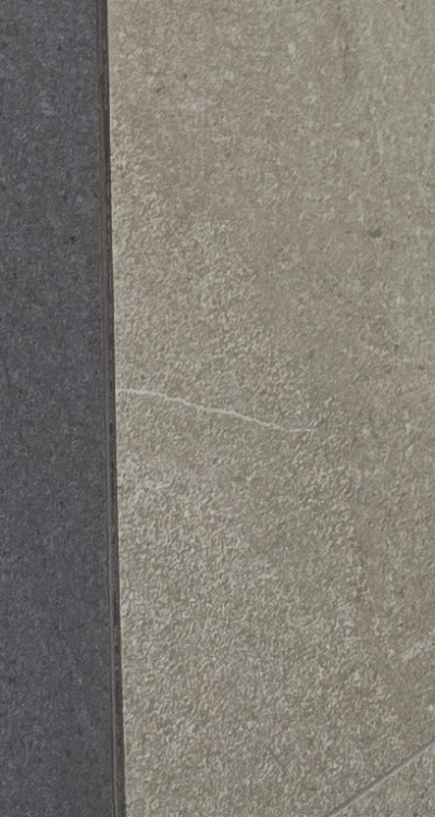 임플란트의 장점 할까 말까 고민이신 분들을 위한 정리 관련 이미지 42