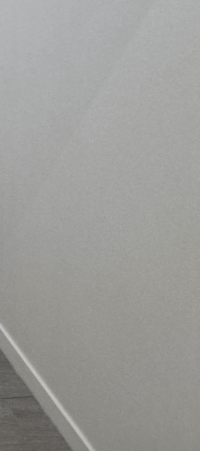 금 크라운 수명 몇년이나 지속될까요 관련 이미지 33
