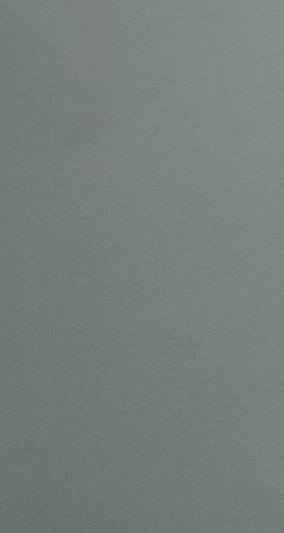 충치 검은점 나타났다면 이렇게 대처해요 관련 이미지 42