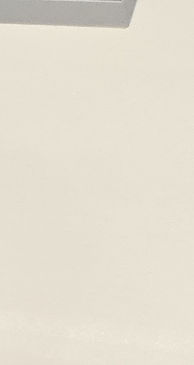 어금니 임플란트 안하면 후회하게 되는걸까 관련 이미지 21