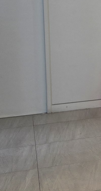 앞니 부분 교정 간단하니까 좋은건가요 관련 이미지 35