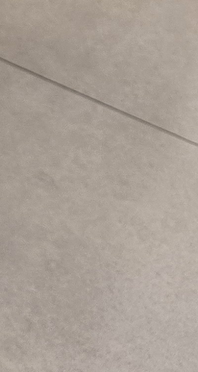 신경치료 아픈가요 망설이시는 분들이라면 관련 이미지 49