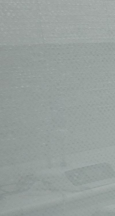 충치 검은점 나타났다면 이렇게 대처해요 관련 이미지 22