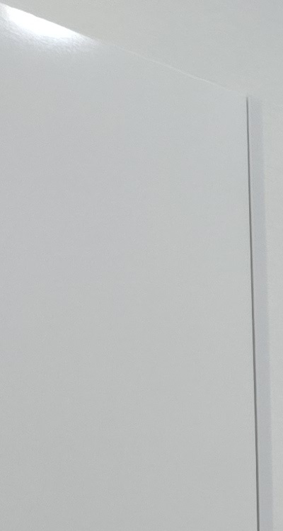 50대임플란트 꼼꼼하게 따져봐야할 포인트는 관련 이미지 13