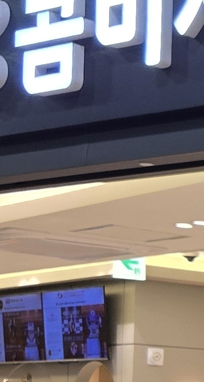 치아 발치 후 임플란트 언제부터 준비할까 관련 이미지 25