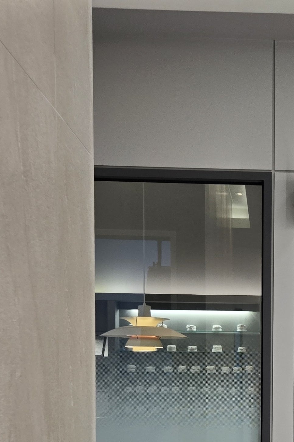 어금니 임플란트 과정 제대로 이해하려면 관련 이미지 24