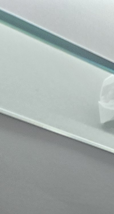 완전매복사랑니 발치 대학병원 꼭 가야하나요 관련 이미지 11