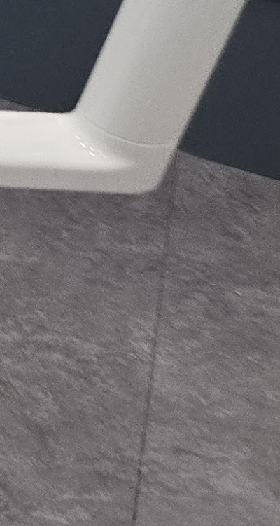 어금니 임플란트 안하면 후회하게 되는걸까 관련 이미지 42