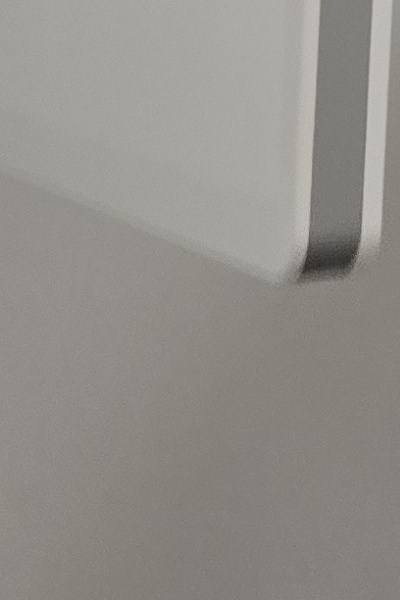 부정교합 교정 안하면 생기는 문제는 뭔가요 관련 이미지 40