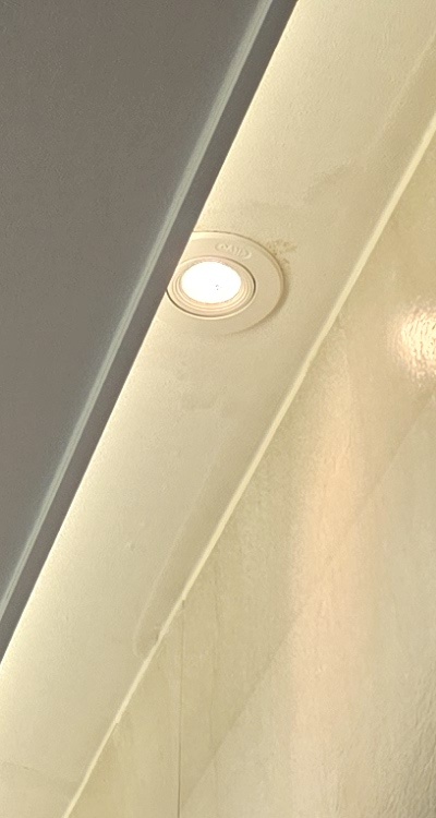 반대교합 치아교정 해결 가능할까 관련 이미지 12