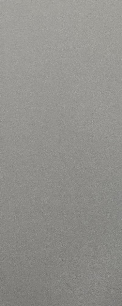 인레이 치료 후 신경치료 이유가 궁금하다면 관련 이미지 42