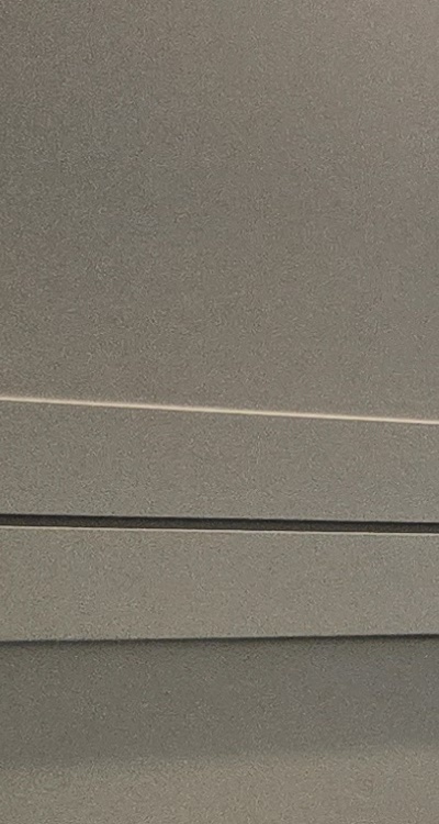 아래 사랑니 발치 통증 미리 알고 대처하려면 관련 이미지 20