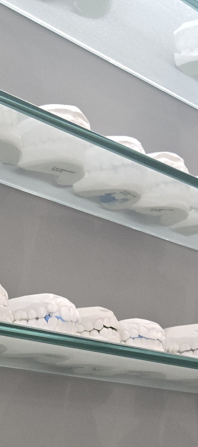 아말감 레진 차이 제대로 이해하려면 관련 이미지 15