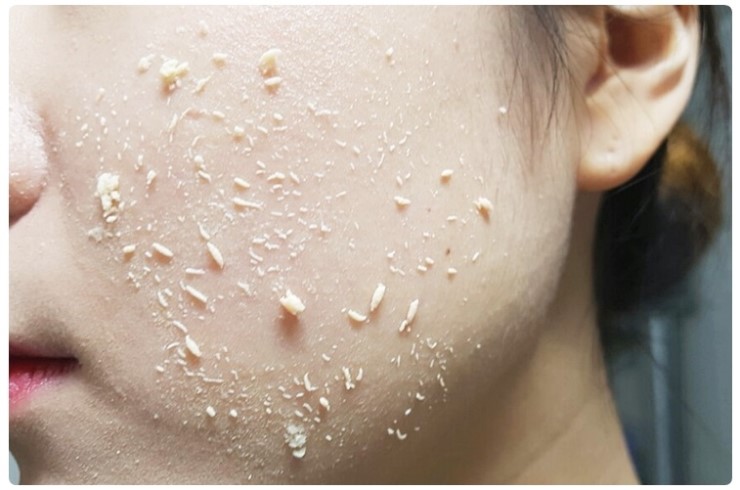 피부트러블 없애버리고 싶다면 관련 이미지 7