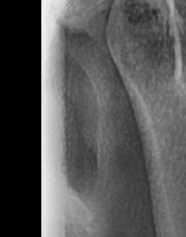 어금니 뒤 잇몸 부음 어떤 문제길래 이런거죠 관련 이미지 18