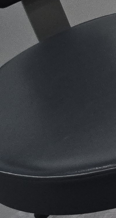 어금니 임플란트 안하면 후회하게 되는걸까 관련 이미지 33