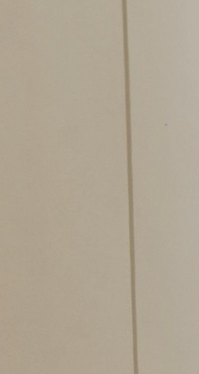 클리피씨교정 장단점 어떻게 비교하면 될까요 관련 이미지 22