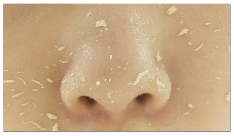 얼굴피지제거 제격이야! 관련 이미지 5