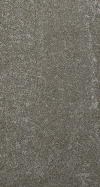 앞니 신경치료 크라운 까지 해야할 상황이라면 관련 이미지 44