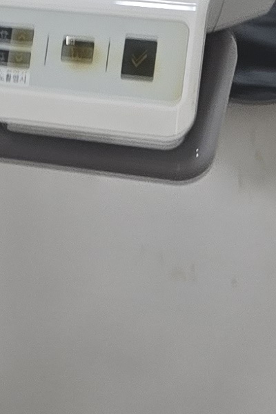 부정교합 교정 안하면 생기는 문제는 뭔가요 관련 이미지 45