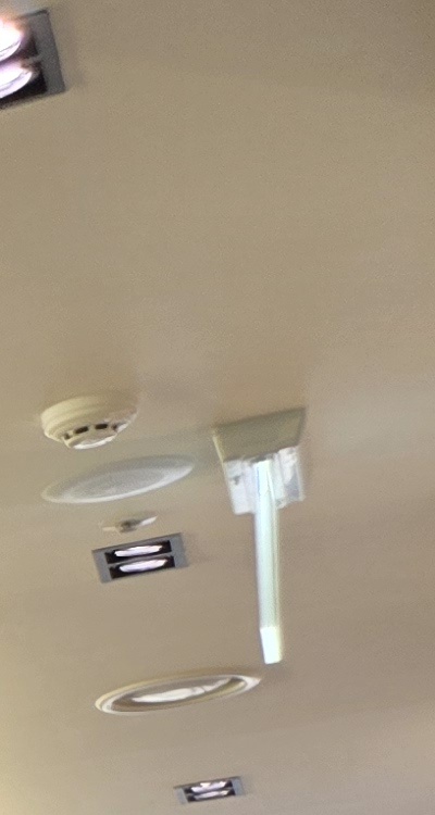 아말감 교체 레진 인레이 어떻게 대처하면 될까 관련 이미지 20