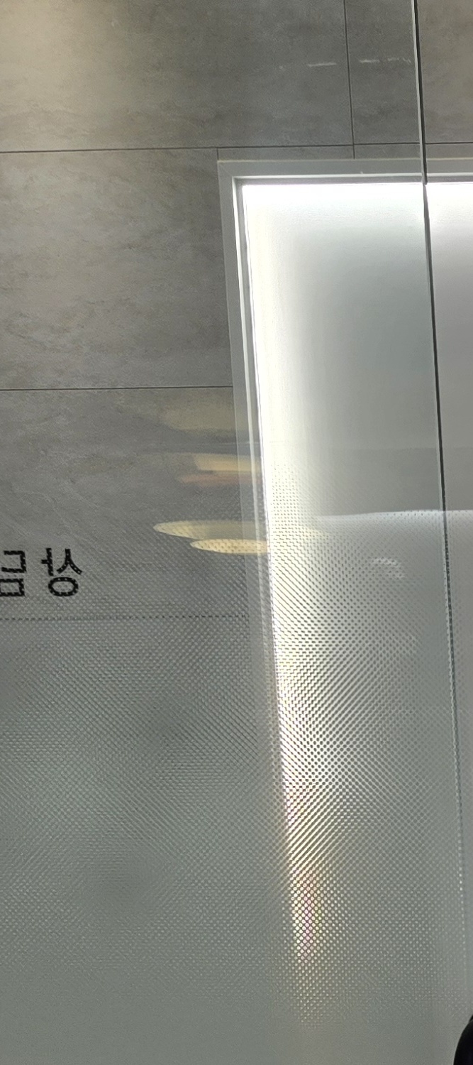 금 크라운 수명 몇년이나 지속될까요 관련 이미지 12