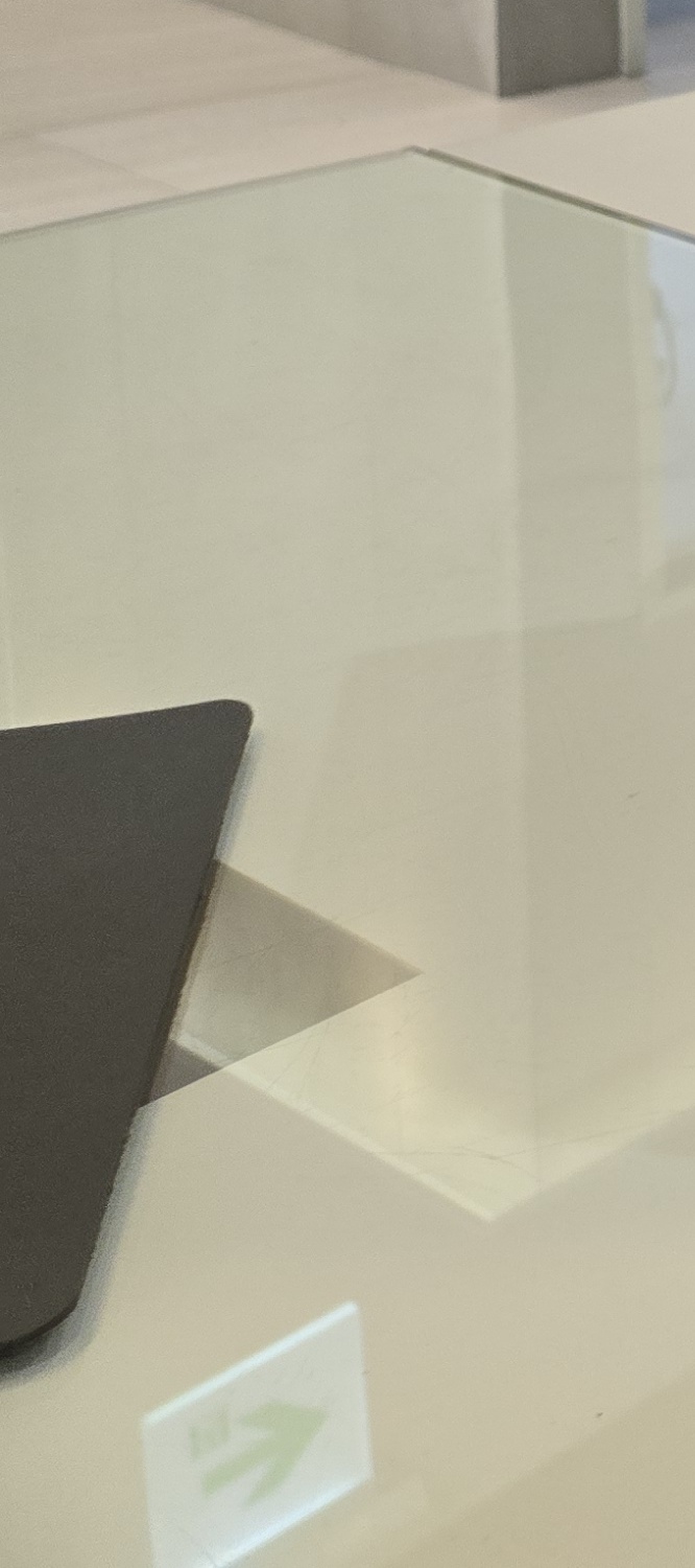 앞니 틀어짐 교정 방법 이럴때는 좀더 간단해요 관련 이미지 15