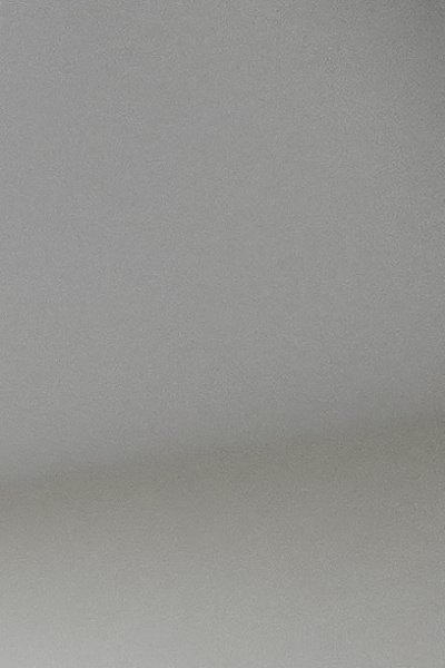 부정교합 교정 안하면 생기는 문제는 뭔가요 관련 이미지 18