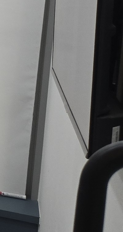 50대임플란트 꼼꼼하게 따져봐야할 포인트는 관련 이미지 41