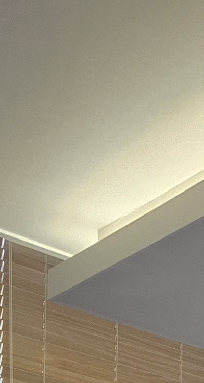 돌출입 팔자주름 교정 얼마나 바뀔까요 관련 이미지 15