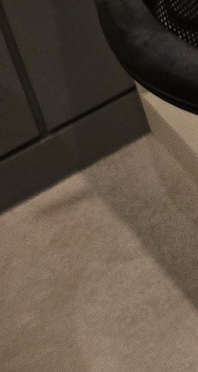 신경치료 아픈가요 망설이시는 분들이라면 관련 이미지 41