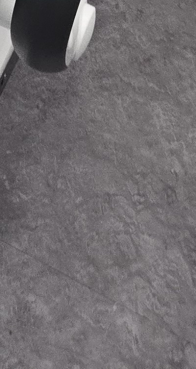 어금니 임플란트 안하면 후회하게 되는걸까 관련 이미지 50