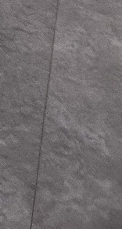 어금니 임플란트 안하면 후회하게 되는걸까 관련 이미지 52