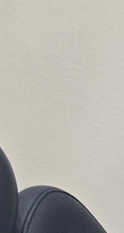 치아 사이 벌어짐 심해지는 이유부터 알아보면 관련 이미지 12