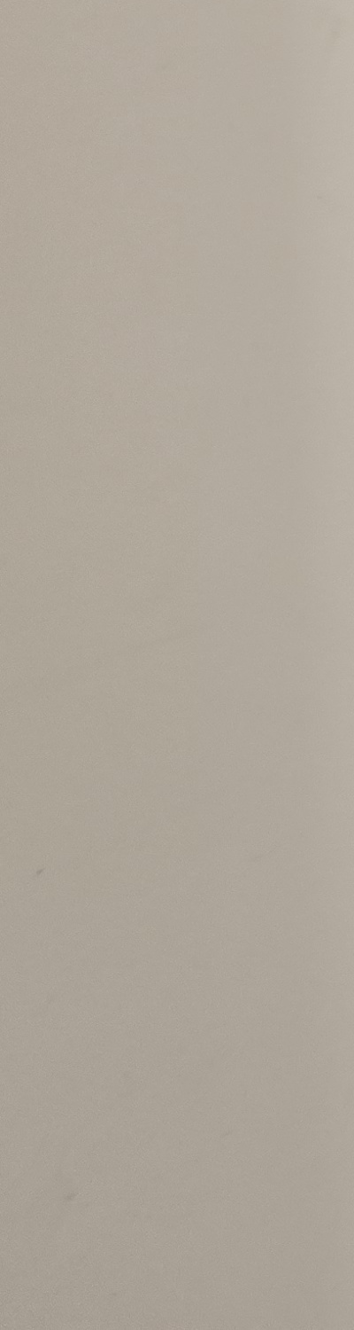 어금니 없으면 얼굴 발음에 어느정도나 안좋을까 관련 이미지 26