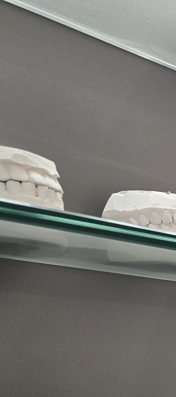 돌출 앞니 교정 이렇게 준비하세요 관련 이미지 23