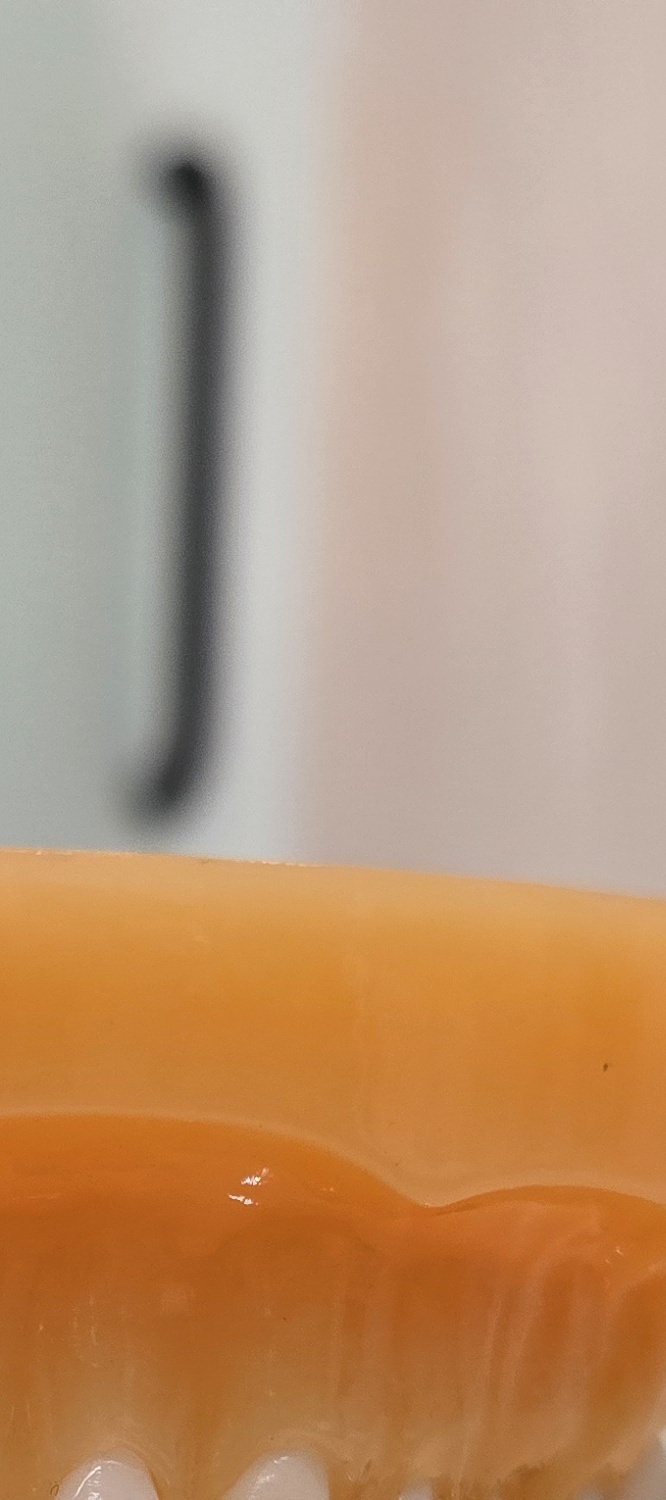 송곳니 덧니 발치 이럴때 해당되네요 관련 이미지 15