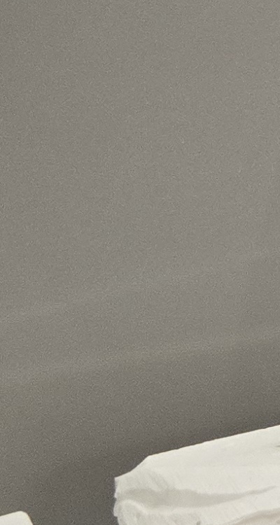 앞니 틀어짐 부분교정 얼마나 걸릴까 관련 이미지 34