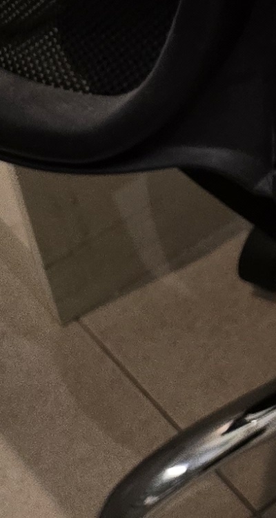 신경치료 아픈가요 망설이시는 분들이라면 관련 이미지 42