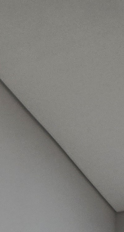 치아 발치 후 임플란트 언제부터 준비할까 관련 이미지 21