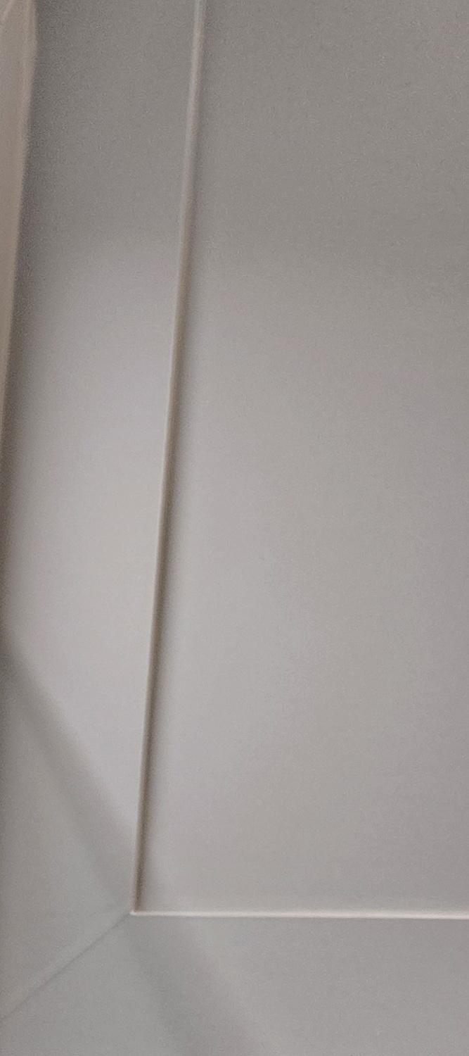 오래된 보철물 아말감 교체 어떠한 케이스일까 관련 이미지 15