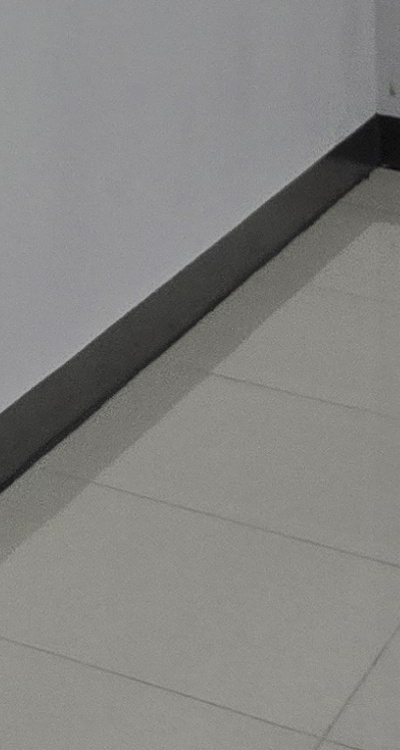 치아 발치 후 임플란트 언제부터 준비할까 관련 이미지 51