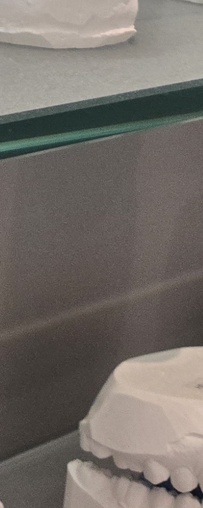 어르신 임플란트 지원 현명하게 활용하려면 관련 이미지 38