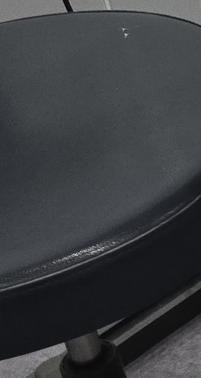 어금니 임플란트 안하면 후회하게 되는걸까 관련 이미지 34