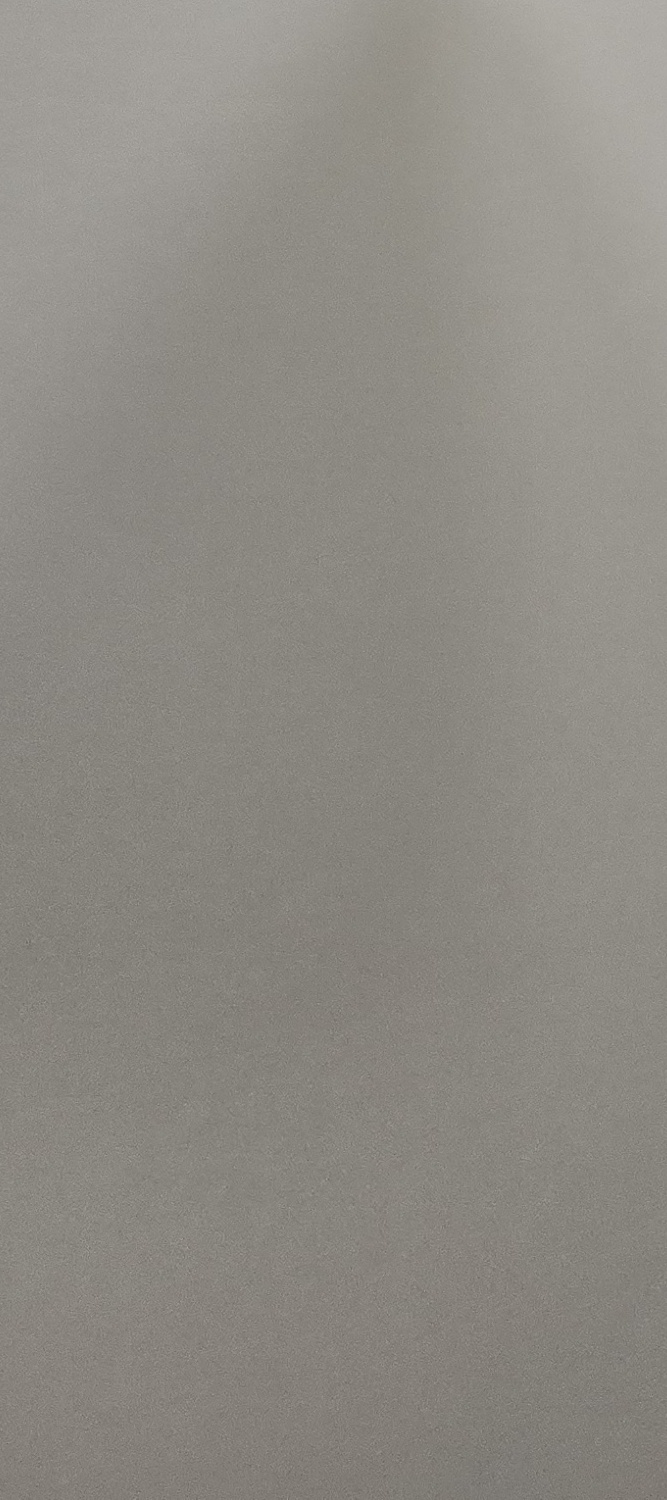 앞니 틀어짐 교정 이렇게 파악하세요 관련 이미지 29